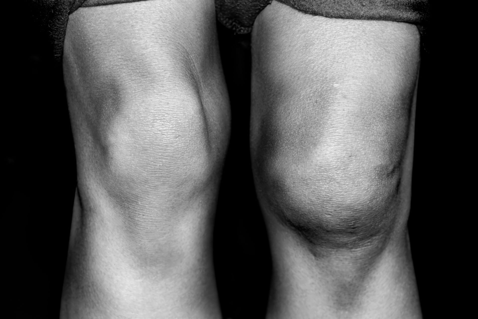 Слабость и боль в коленном суставе